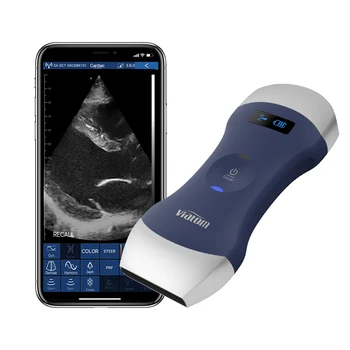 Bezdrôtový Ručný Ultrazvuk Skener Hmotnosť 260 g/0.6 Kg Kompatibilné s Tablety a Iphone/android Prenosný Ultrazvuk
